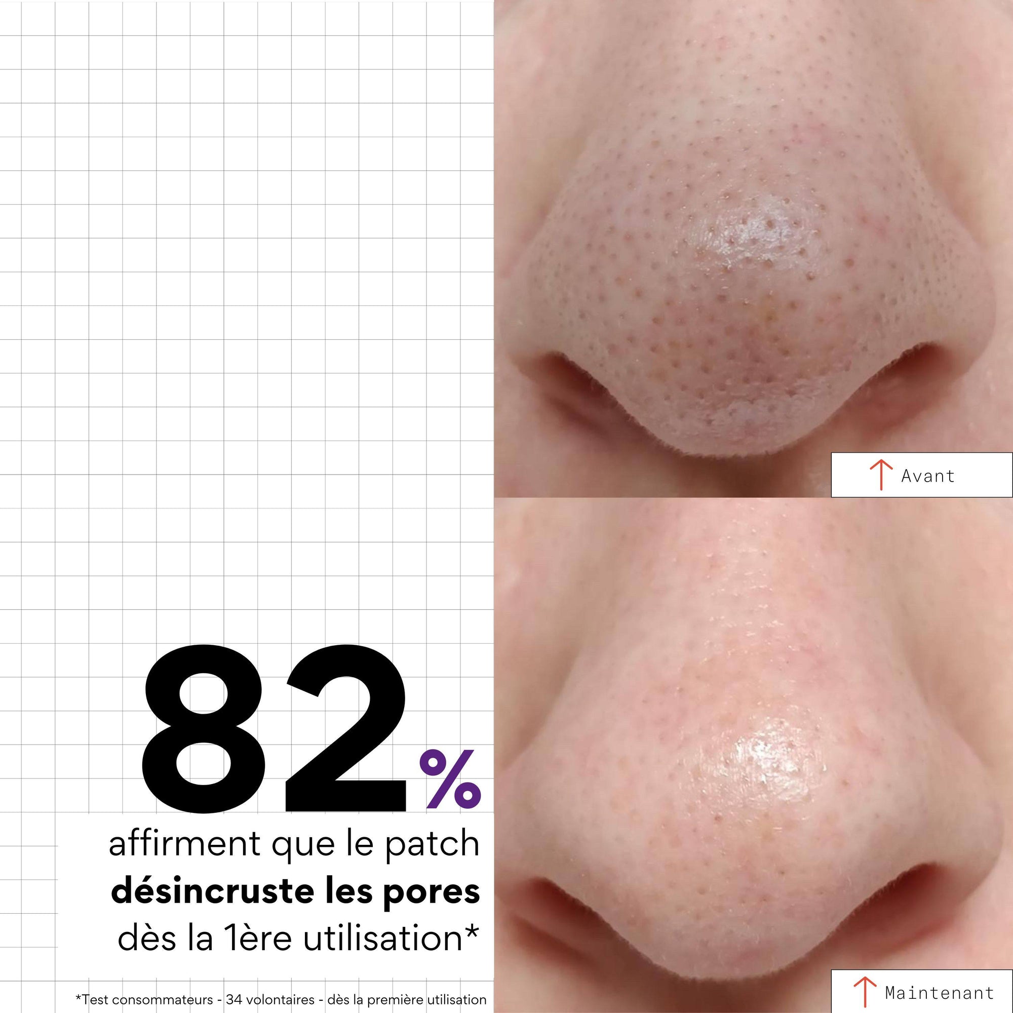 PEEL OUT Patchs nez purifiant x5