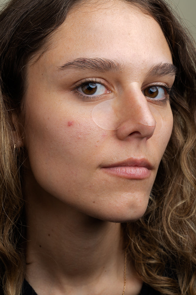 PEEL OUT Patchs nez purifiant x5